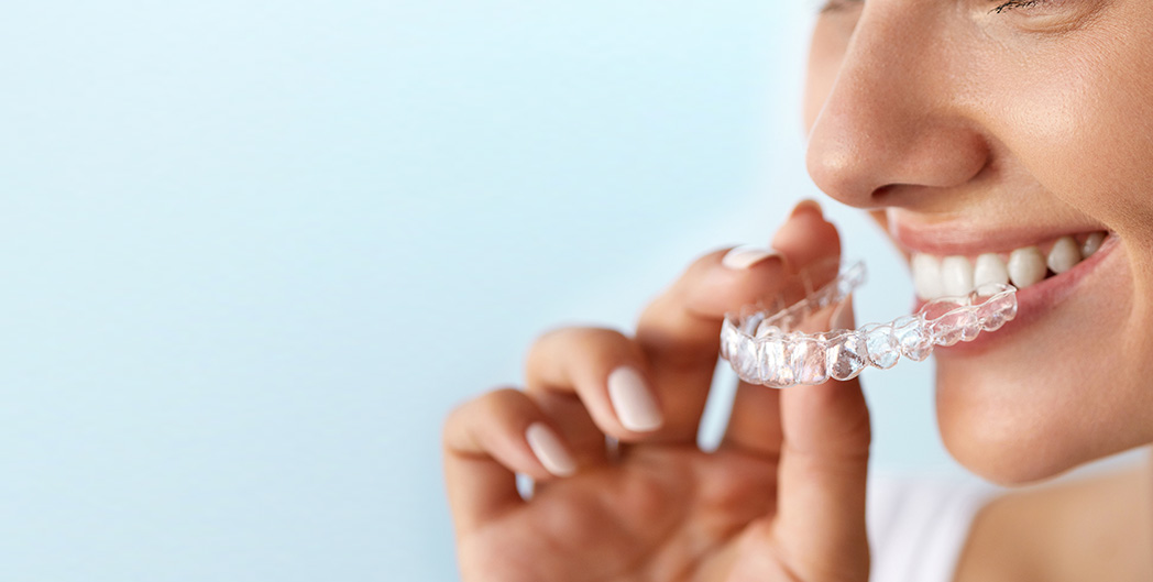 Invisalign Discount
