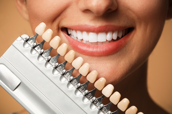 Myths And Facts About Dental Veneers