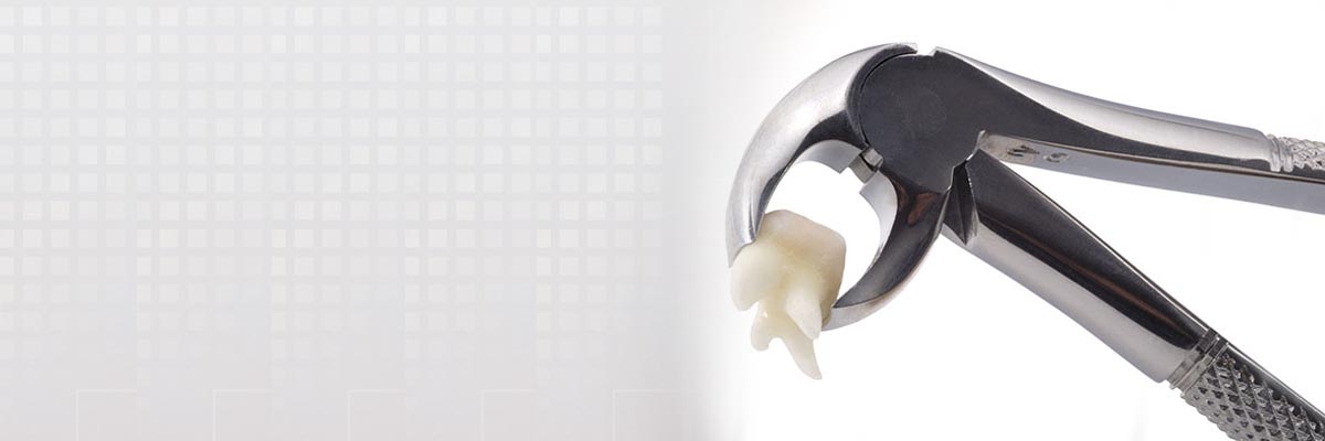 Los Angeles Tooth Extraction
